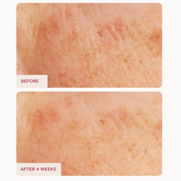 Caviar Lime Acid Peel - - Picture 5 of 6